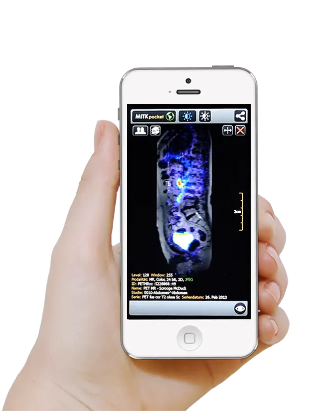 Apple Watch Thumbnail